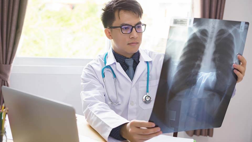 ilustrasi dokter memeriksa hasil rontgen untuk cek kanker paru